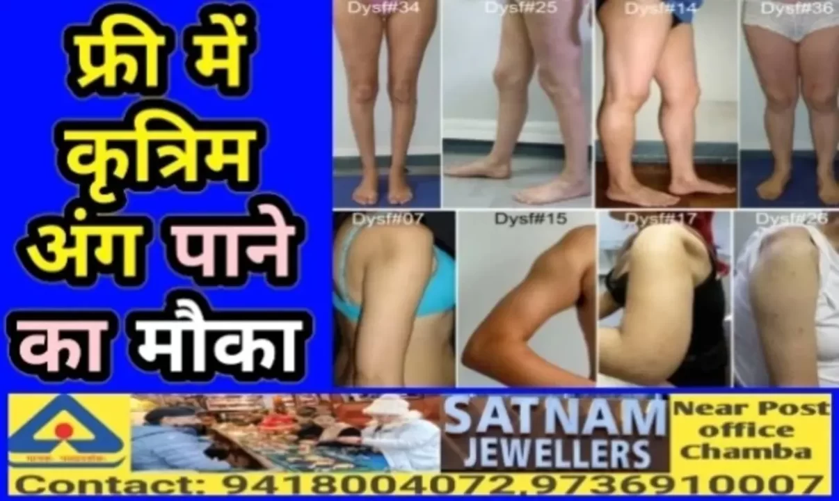 Free artificial limbs in Chamba